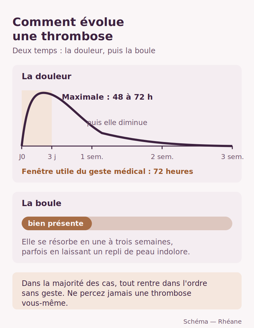 Thrombose hémorroïdaire : douleur maximale pendant 48 à 72 heures puis boule qui se résorbe en une à trois semaines
